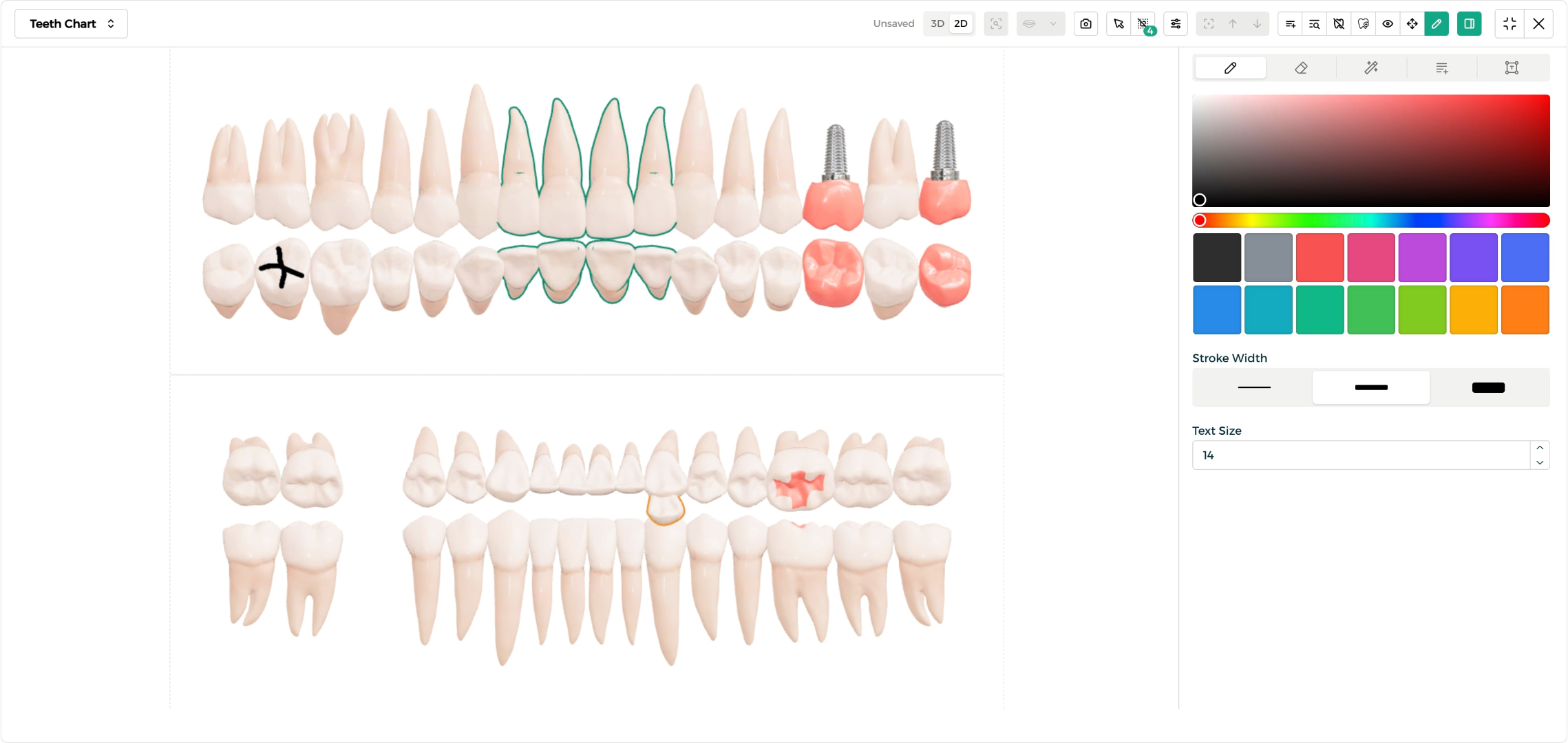 Step 3 - Draw a marker on a tooth